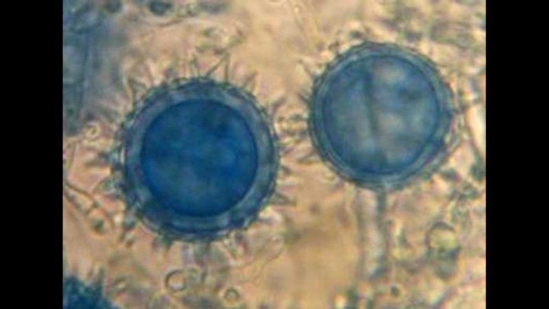 Pythium oligandrum Pythium oligandrum